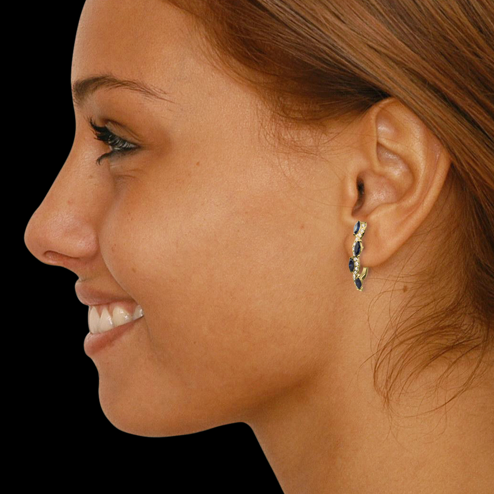 https://goldiam.co.il/sites/default/files/10174_ear.jpg